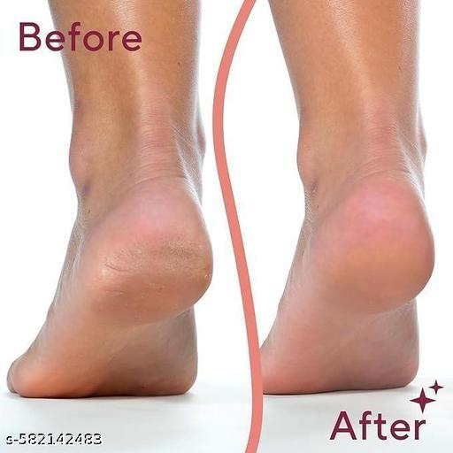 Foot Callus Remover By painfreez